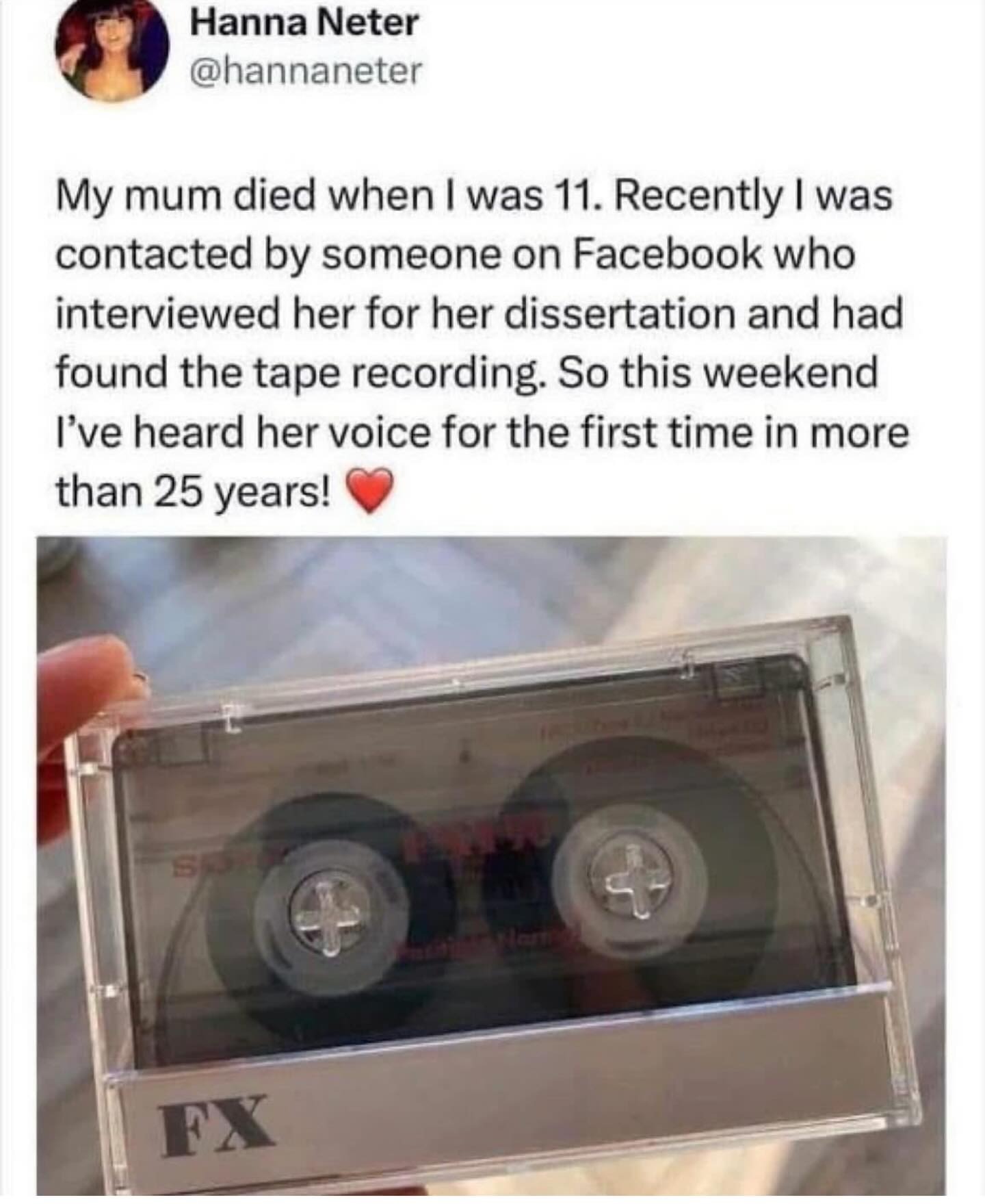 18865 33